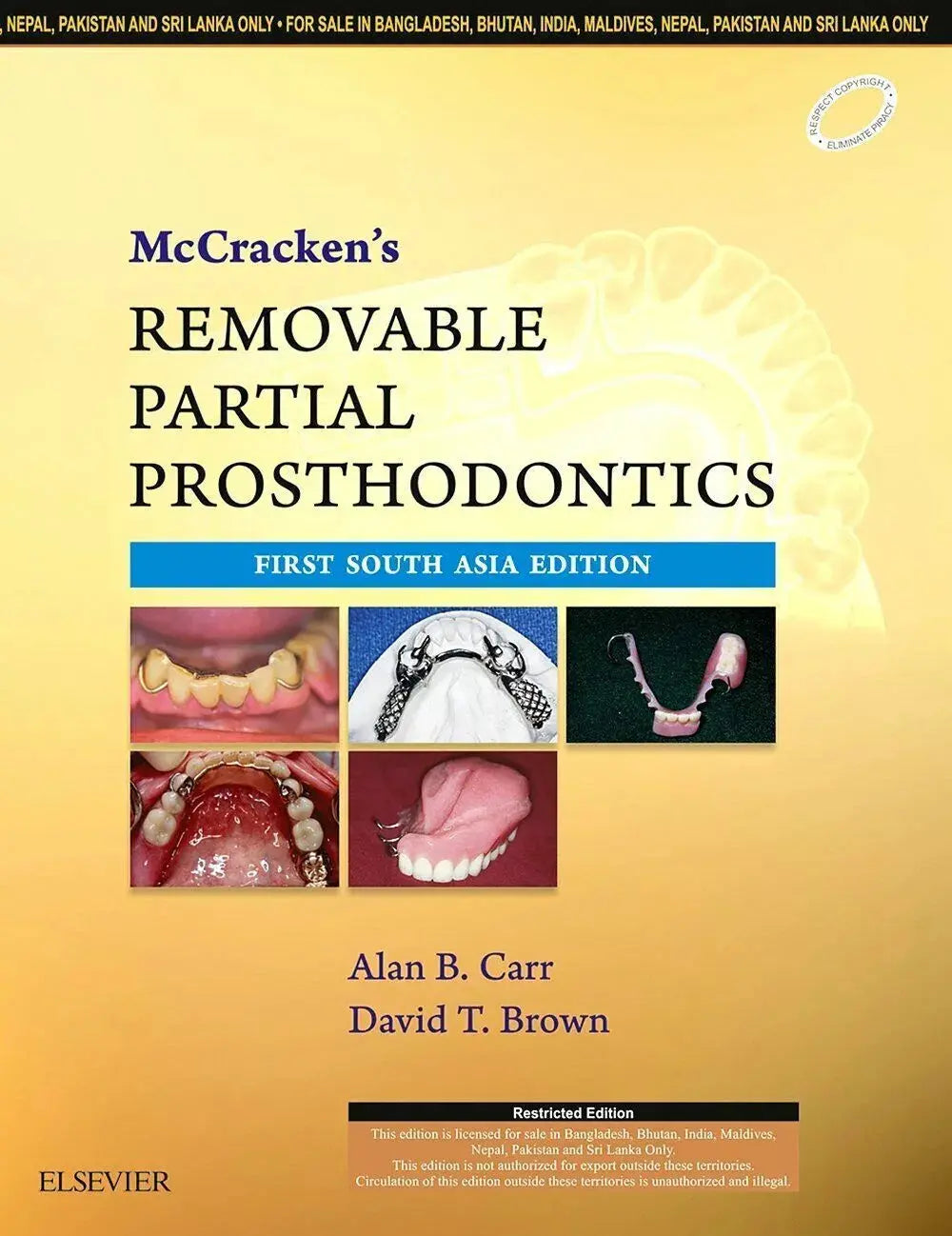 Mccrackens Removable Partial Prosthodontics 13Th Edition - bestbooksdeals